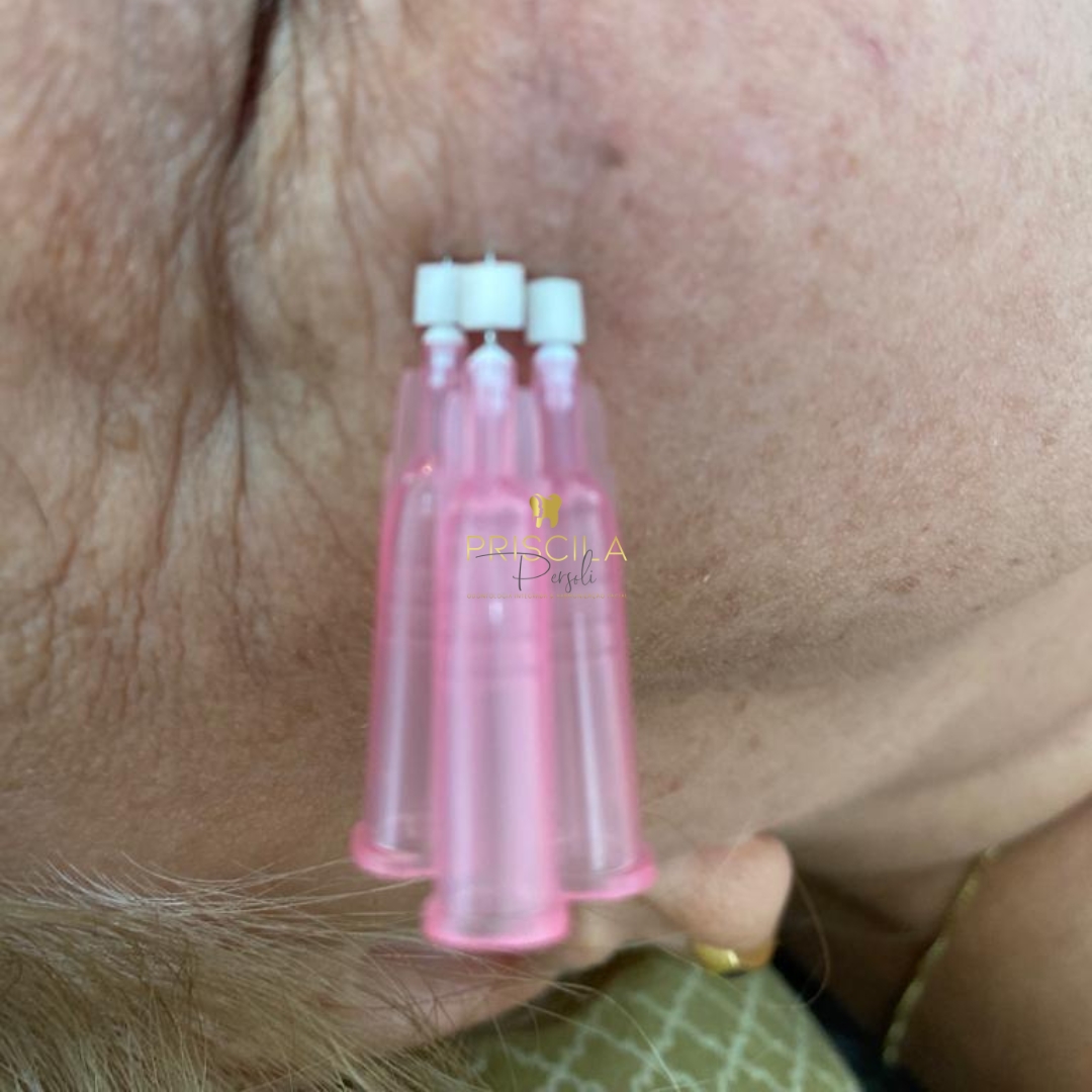 Dra. Priscila Persoli Fios de PDO #2.E